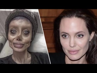 Девушка мечтала стать копией Анджелины Джоли, но ее осудили на 10 лет за эту жажду славы