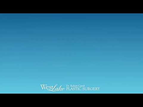 Breast Massage Video: Asymmetry with Implant Position Robert Caridi,