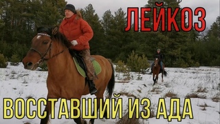Восставший из ада. Реабилитация (острый лимфобластный лейкоз)