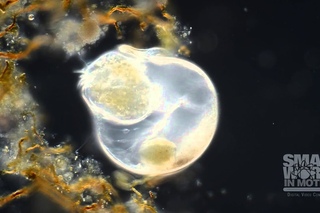 Trachelius ciliate feeding on a Campanella ciliate