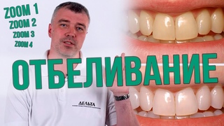 Вредно ли ОТБЕЛИВАНИЕ ЗУБОВ Какой ZOOM 1 2 3 4 лучше (Школа здоровых зубов) #шзз