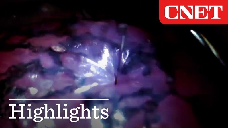 Watch Neuralink Scientist Demo Brain Chip Insertion