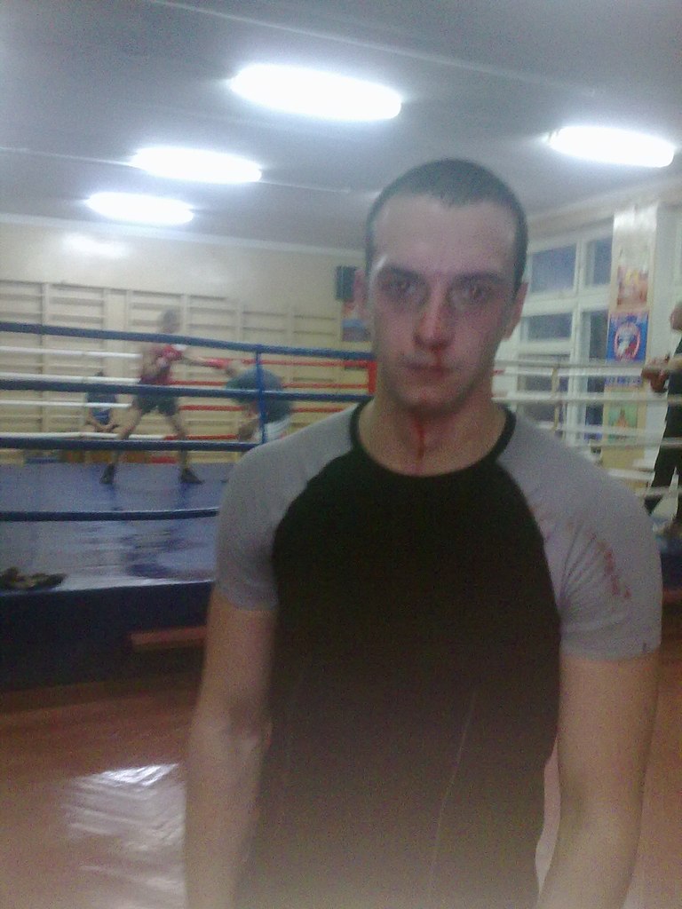 Антон Матуся | Lyon