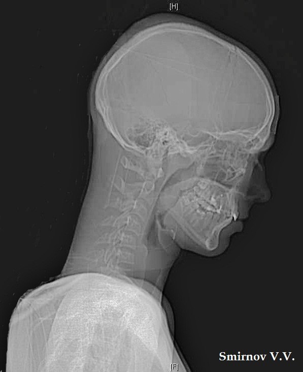 Веталь Смирнов | Херсон