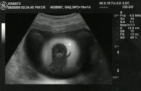 Елизавета Губанова | Москва