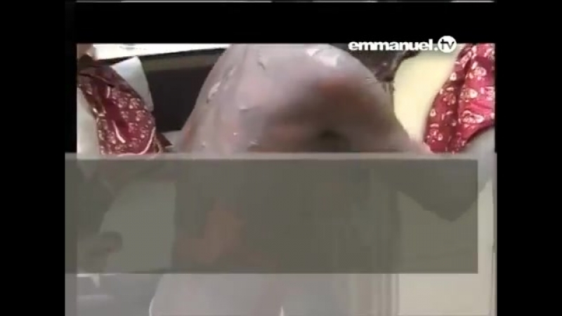 Ти Би Джошуа ИСЦЕЛЕНИЕ разлагающегося