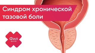 Синдром Хронической Тазовой Боли Лечение |Хронический асептический простатит | Симптомы простатита
