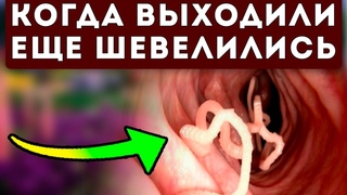 Зачем запрещают об этом говорить... Глисты Вылетят даже после...