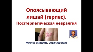Опоясывающий лишай (герпес). Постгерпетическая невралгия