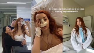 риносептопластика в Москве, почему пришлось переделывать нос