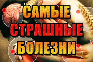 САМЫЕ СТРАШНЫЕ БОЛЕЗНИ (ШОК!!! 18+)