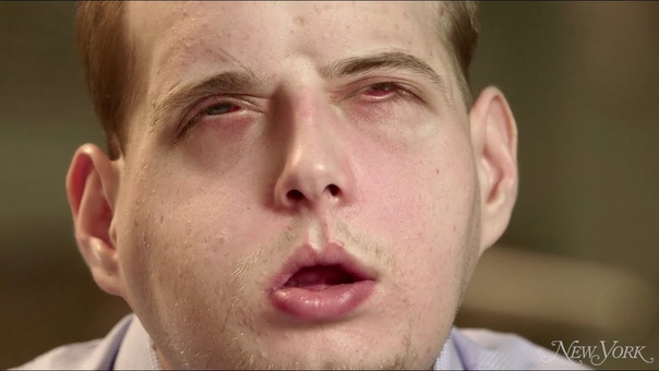 Man Gets Full Facial