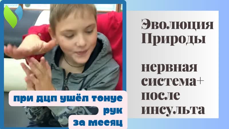 ДЦП Ярослав 1 месяц приема После инсульта, Нервная