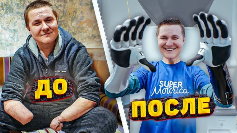ДО СЛЁЗ НОВЫЕ РУКИ ДЛЯ САШИ НЕВЕРОЯТНЫЙ ФИНАЛ В ЖИЗНИ