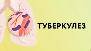 Туберкулез // Это должен знать каждый